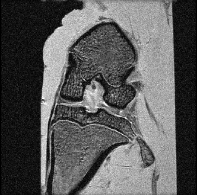 大鼠膝关节解剖MRI - 生物医学研究成像中心- manbetx注册页,manbet安全